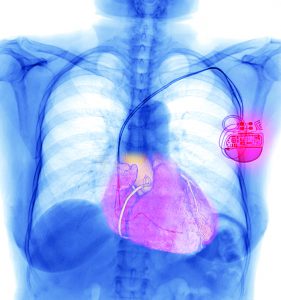 Circuit checkers for medical devices